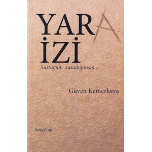 Yara İzi